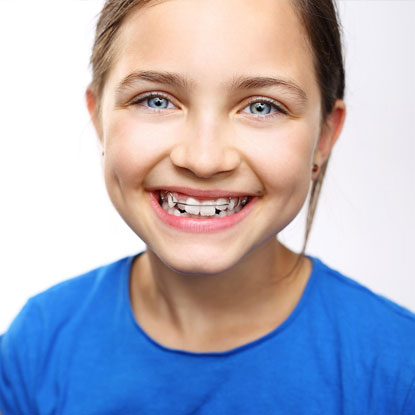 retainers